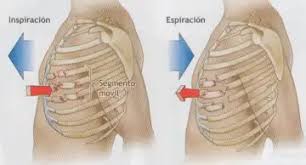 Image result for Flail Chest