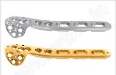 Proximal Humerus Plate, Proximal Humerus Plate Manufacturer ...