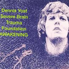 As a Global Ambassador for The Lupus Foundation of America, I'm putting