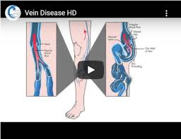 Home La Bella Vita Laser And Vein Center Cardiovascular Surgeons
