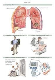 We did not find results for: Infections Of The Lower Respiratory Tract May Involve The Airways Lung Parenchyma Or Pleural Space Pneumonia Community Acquired Pneumonia Lung Infection