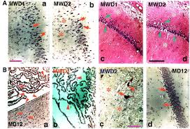 We did not find results for: Nerve Cell An Overview Sciencedirect Topics