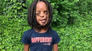 The hair can be separated in as many parts as you like, and any part is done in a wrap. 11 Year Old Girl Teaches Valuable Lesson About Embracing What Makes Your Different Gma