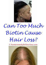 Pin On Treat Hairloss