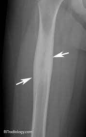 Pin Di Omz Su Radiology Diagnostica Per Immagini Immagini