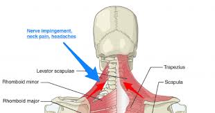 The rotator cuff is a collection of muscles and tendons that surround the shoulder, giving it support and allowing a wide range of motion. The Link Between Posture And Chronic Neck And Upper Back Pain Back Pain And Headache Specialist Burke Va Nova Headache Chiropractic Center