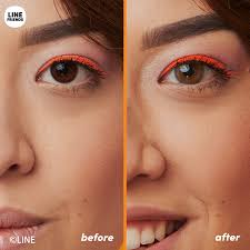 Contact Lens Order Form