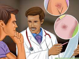 Now, going back on track, ingrown hairs, in most cases, are harmless. 3 Ways To Prevent Ingrown Hairs On The Pubic Area Wikihow