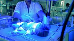 Image result for Phototherapy