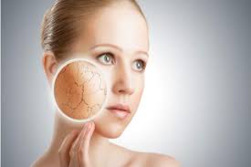 The maritime city's winters have on average 2.13 days straight of unrelenting snow, and the army is never called to the rescue. Winter Skin Care Tips For Dry Skin Best Home Remedies For Dry Skin This Winter India Com