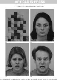 Apert's syndrome (a type of acrocephalosyndactyly) — observations on a british series kreiborg s., cohen m. Pdf Differential Activation Of The Amygdala And The Social Brain During Fearful Face Processing In Asperger Syndrome Semantic Scholar