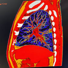 Pentru detalii si programari sunati la. Clinica Medicaltop Bacau Servicii Medicale Specializate Prima Pagina