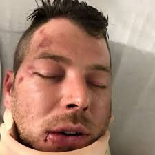 Fundraiser for Jonathan Morgan by Pam Saylor : Greektown Hotel  Assault-Morgan