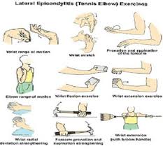 Thus in tennis elbow, flexion, and extension motion cause difficulty and pain. Tennis Elbow Exercises Michigan Sports And Spine Center