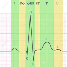 Marking Scheme Of Ecg On Grid Paper Ekg Graph 2d Medical Vector