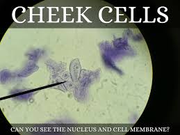 There is a nucleus accumbens in each cerebral hemisphere; Cells Under A Microscope By Jaimarie Nelson