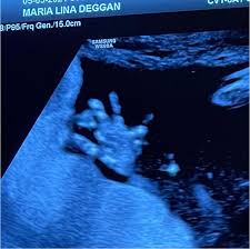 May 31, 2021 · pai de whindersson nunes lamenta a morte do neto: Foto Whindersson Nunes Posta Ultrassom De Bebe Com A Noiva De Sc Maria Lina