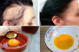 как ускорить рост волос в домашних условиях за неделю Udivitelnyj Recept Poproshajtes S Zaderzhkoj Zhidkosti Otyokami I Lishnim Vesom Vsego Z Uskorit Rost Volos Sredstva Dlya Rosta Volos Sredstva Ot Vypadeniya Volos