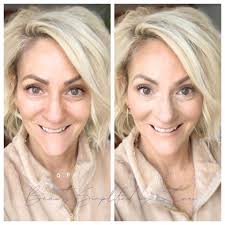 What are some effective skincare treatments for oliy skin and pimple  removal?