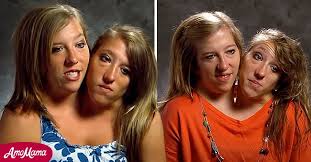 Abby and brittany are not yet married as far as reports suggest. All We Know About World Famous Conjoined Twins Abby And Brittany Hensel S Private Lives And Careers