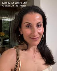 This is 60! 🎂 I wanted to highlight this unbelievable transformation and  take the opportunity to wish my beautiful patient a happy birthday!