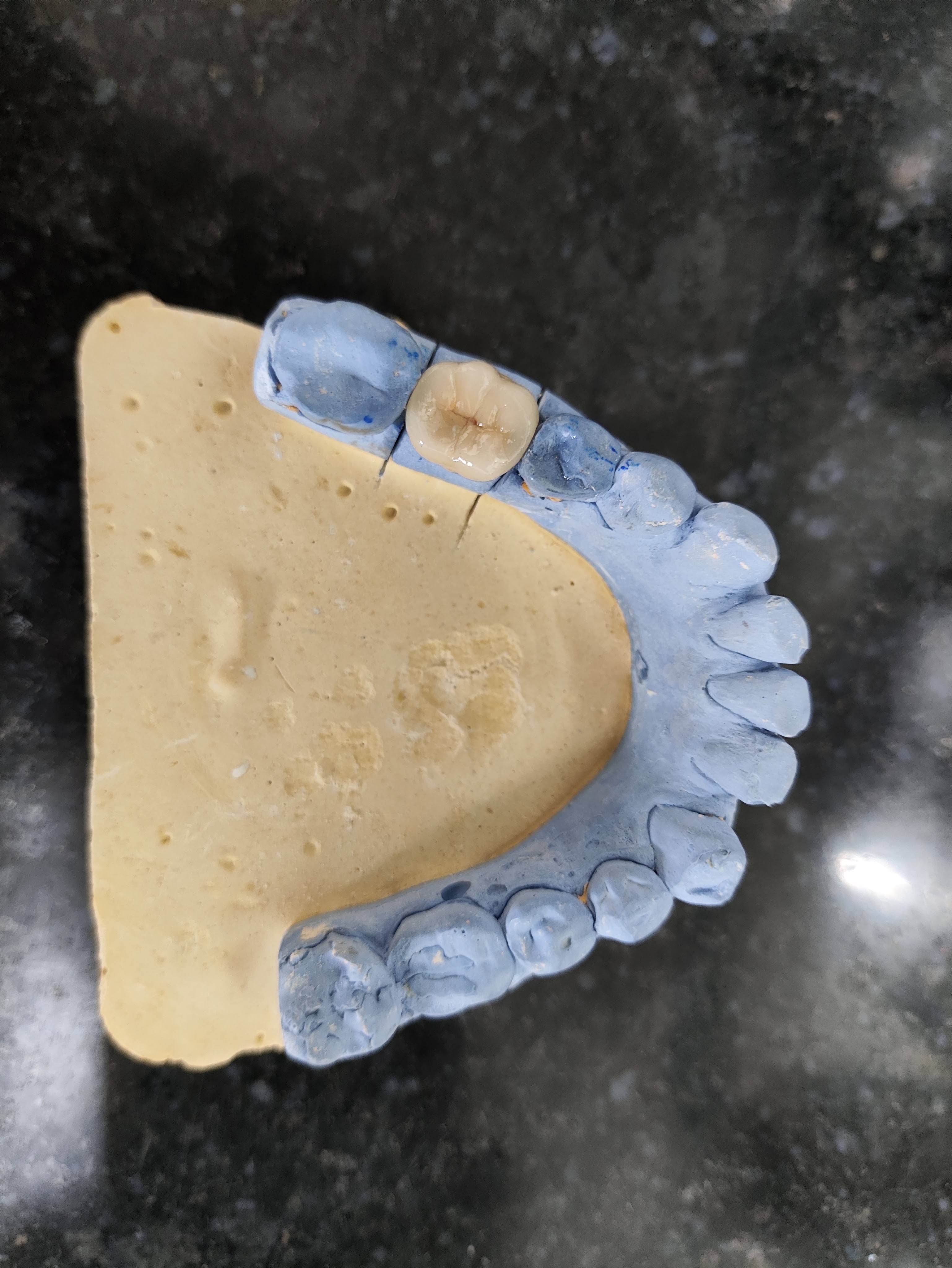 Dental cap