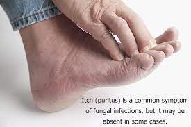 Medical experts weigh in on recent research. Can Hydrogen Peroxide Rubbing Alcohol Treat Ringworm