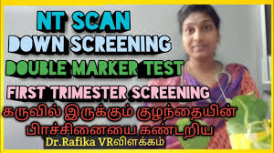 Adhavan ஆதவன் m tamil means sun in tamil. Screening And Diagnosis Of Downs Syndrome In Pregnancy By Medishare Tips
