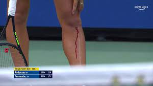 Amazon Prime Video Sport on X: Emma Raducanu is putting her body on the  line! #USOpen t.covFNvRb5Z96  X