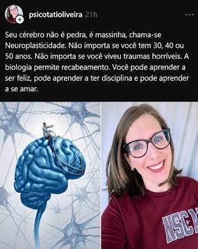 A neuroplasticidade molda nosso cérebro continuamente., AI generated