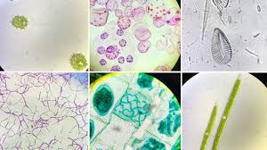 Check spelling or type a new query. Microscopic Slides Of Algae Live And Prepared Youtube