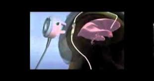 Shunting To Treat Hydrocephalus Spinal Fluid Brain Surgery Child Life