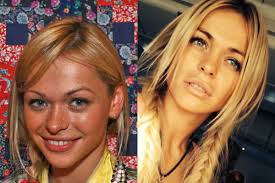 Биография и личная жизнь анны хилькевич стала интересовать российских зрителей после того, как на телеканале «тнт» вышел популярный ситком «универ.новая общага». Anna Hilkevich Do I Posle Plastiki Kakie Plasticheskie Operacii Ona Delala I Kak Pomenas Ee Vneshnost Novosti I Foto 2021