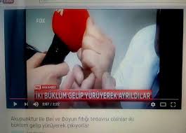 Boyun Fitigi Icin Sol Eli Yumruk Yapinca Serce Parmagin Olusturdugu Ikinci Cizginin On Ve Arkasina Hafif Basinc Yapin Sabah Ve A Akupunktur Saglik Bel Fitigi