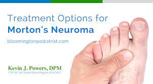 No More Morton S Neuroma Kevin J Powers Dpmkevin J Powers Dpm