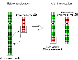 Robertsonian translocation and isochromosome are two chromosomal abnormalities. Chromosomal Translocation Wikipedia
