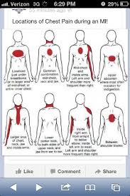 Pin By Lisa Bandermann On Medical Information Signs Of Heart Attack Heart Attack Symptoms Medical Information