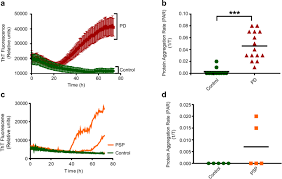 Maybe you would like to learn more about one of these? Ultrasensitive Detection Of Aggregated A Synuclein In Glial Cells Human Cerebrospinal Fluid And Brain Tissue Using The Rt Quic Assay New High Throughput Neuroimmune Biomarker Assay For Parkinsonian Disorders Springerlink
