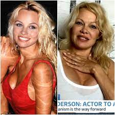 Pamela an p diddy swimming lifeguard puff daddy paul anderson diddy richie rich anderson pamela anderson peta man blazer jeans. Pamela Anderson Plastic Surgery See Before And After Photos