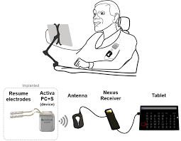 In the next few years, we might be able to control our powerpoint the idea of humans interacting with devices is a pillar of bcis, as bci technology provides direct communication between the brain and external devices. Implanted Brain Computer Interface For Communication In People With Motor Impairment Mds Abstracts