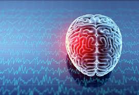 Image result for Concussion