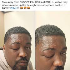 A man took to Facebook alleging that the pillows at the 3.1 star Budget Inn  & Suites Stockton off Hammer Lane messed his face up! 🤪 He stated: “Stay  away from BUDGET
