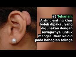 Health 3 penyebab sakit telinga saat menelan. Keloid Penyebab Gejala Dan Cara Mengatasinya Doctoroncall