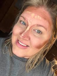 Alternative placement locations for Dexcom G7