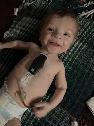 Heart catheterization procedure update and recovery