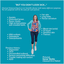 Image result for Homocystinuria