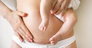 This week, the citizen science program coralwatch held their annual workshop at the station. 30 Powerful Quotes For C Section Moms Simply Well Balanced