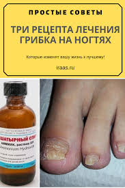 как вылечить грибок на ногах в домашних условиях видео Lozhku Nashatyrnogo Spirta Neobhodimo Razvesti V Stakane Vody V Etom Rastvore Neobhodimo Smochit Lyu Tovary Dlya Zdorovya Lichnaya Gigiena Dieta Dlya Ploskogo Zhivota