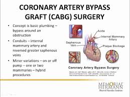 Coronary artery disease (cad) is the most common type of heart disease in the united states. Coronary Artery Disease Memorial Hermann