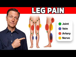 Image result for Leg Pain